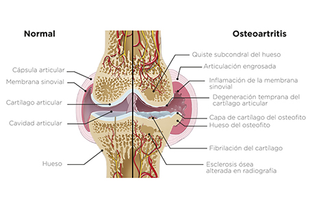 osteoartritis felina